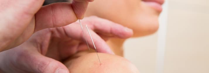 Chiropractic Groton CT Acupuncture Chiropractic Groton CT Acupuncture